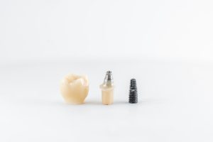 Does Medicare cover dental implants?